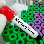 marburgvirusushutterjpg-ZlgtdYo65kCEWvOMocjXrg.jpg