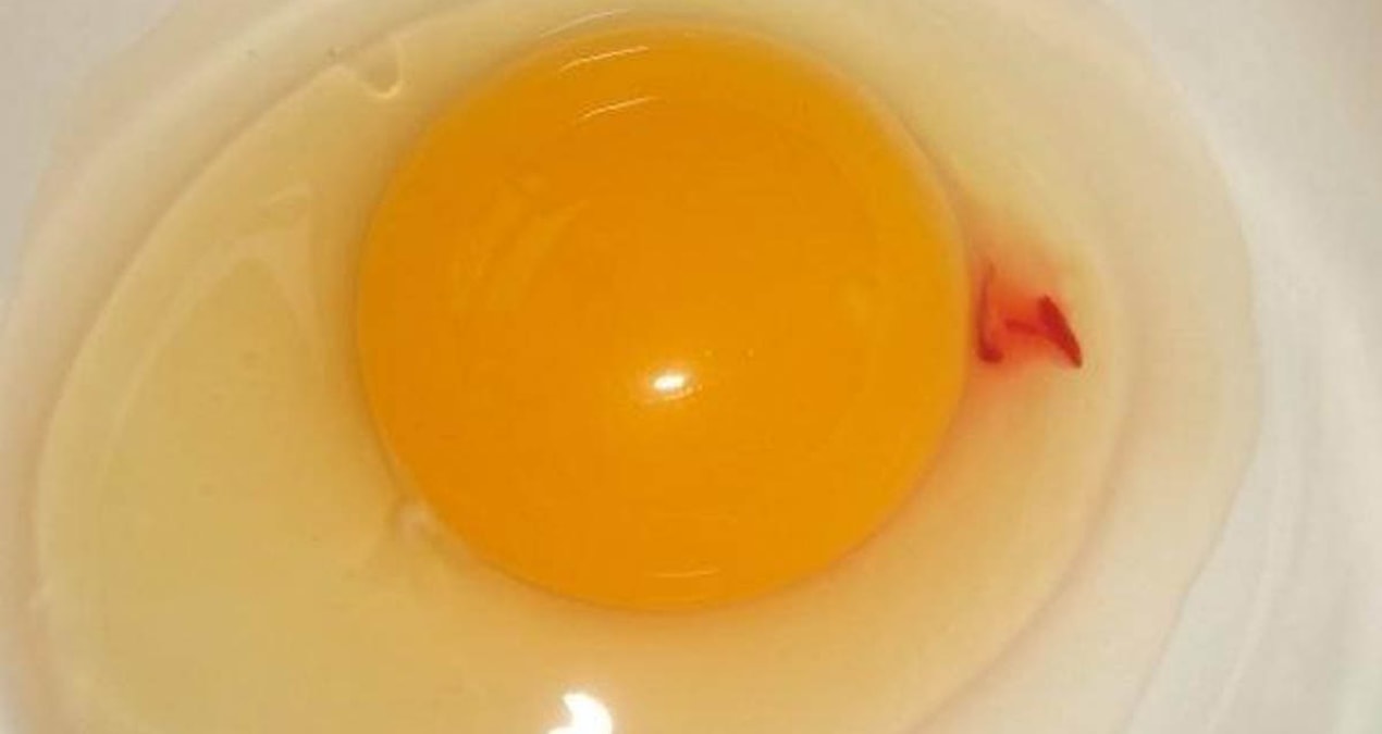 yumurta-lekejpg-UEJAJPo500_0oDa_6Lw6zw.jpg