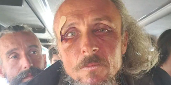 İsrail, Sumud Filosu’na Saldırdı: Türk Vatandaşına Darbe!