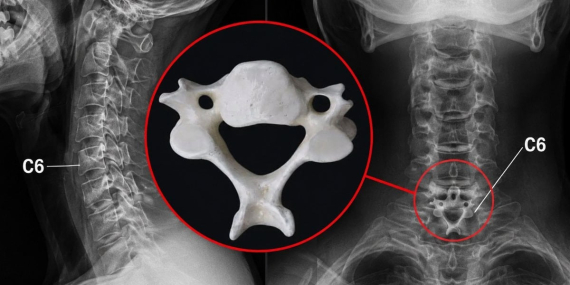 Gülen C6 Omuru: Anatomideki İlginç Detay!